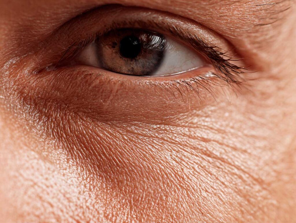 Close-up of a human eye with wrinkles