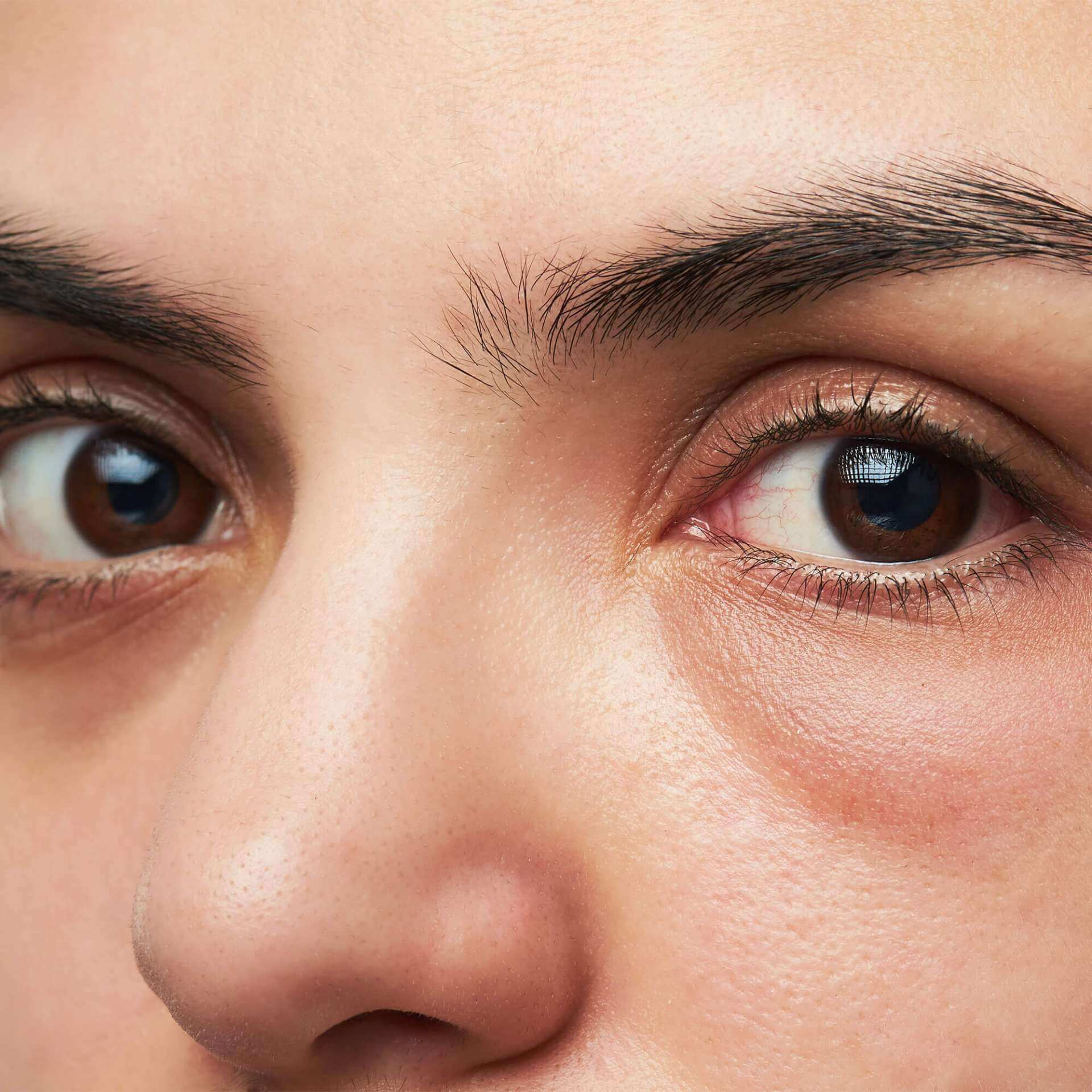 Grens Alstublieft invoer Under Eye Dark Circles and Puffiness - the causes and treatments - Reviva  Labs