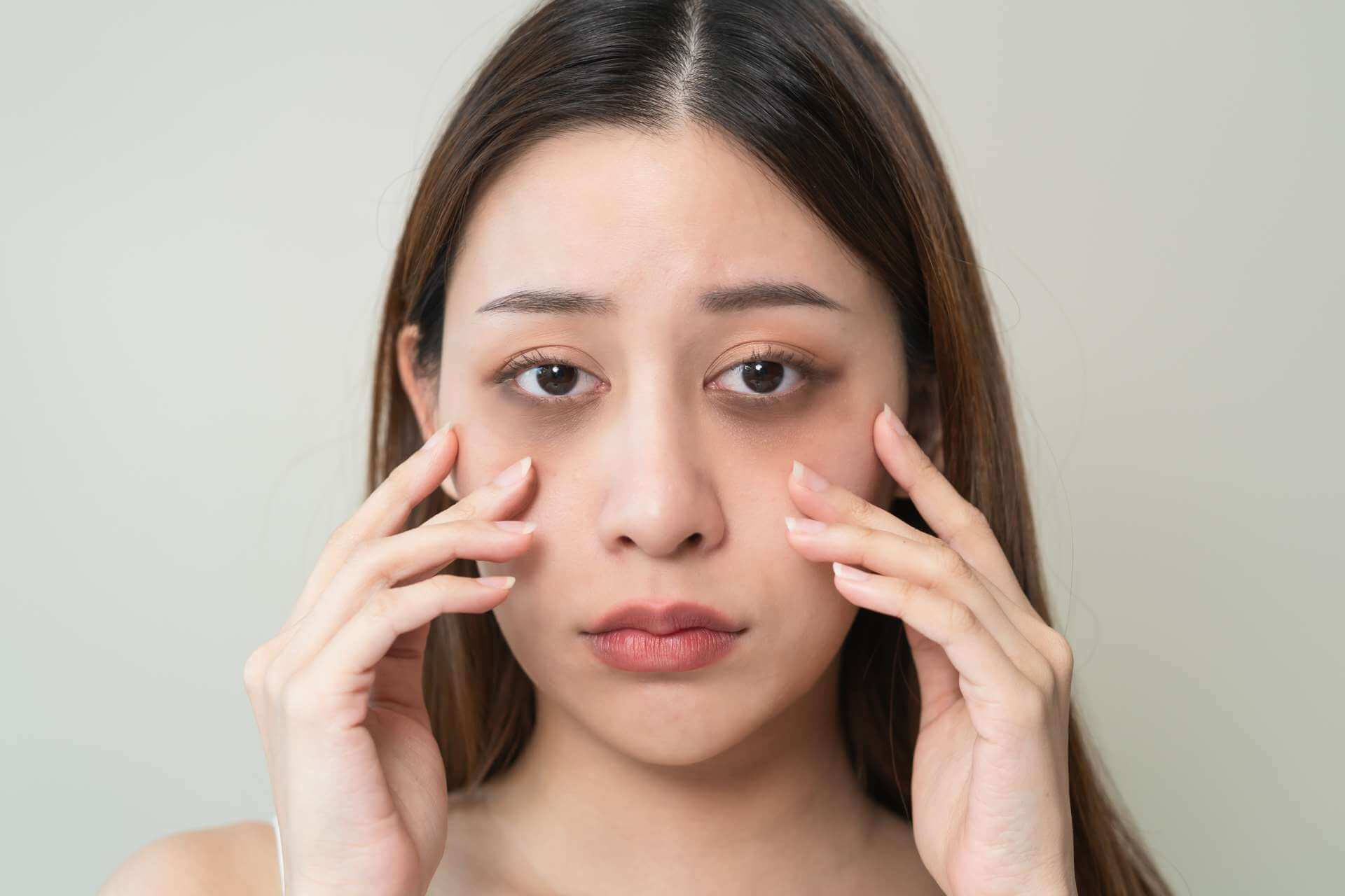 How To Deal with Dark Circles Under Your Eyes - Reviva Labs