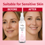 Before and after using rosewater facial spray