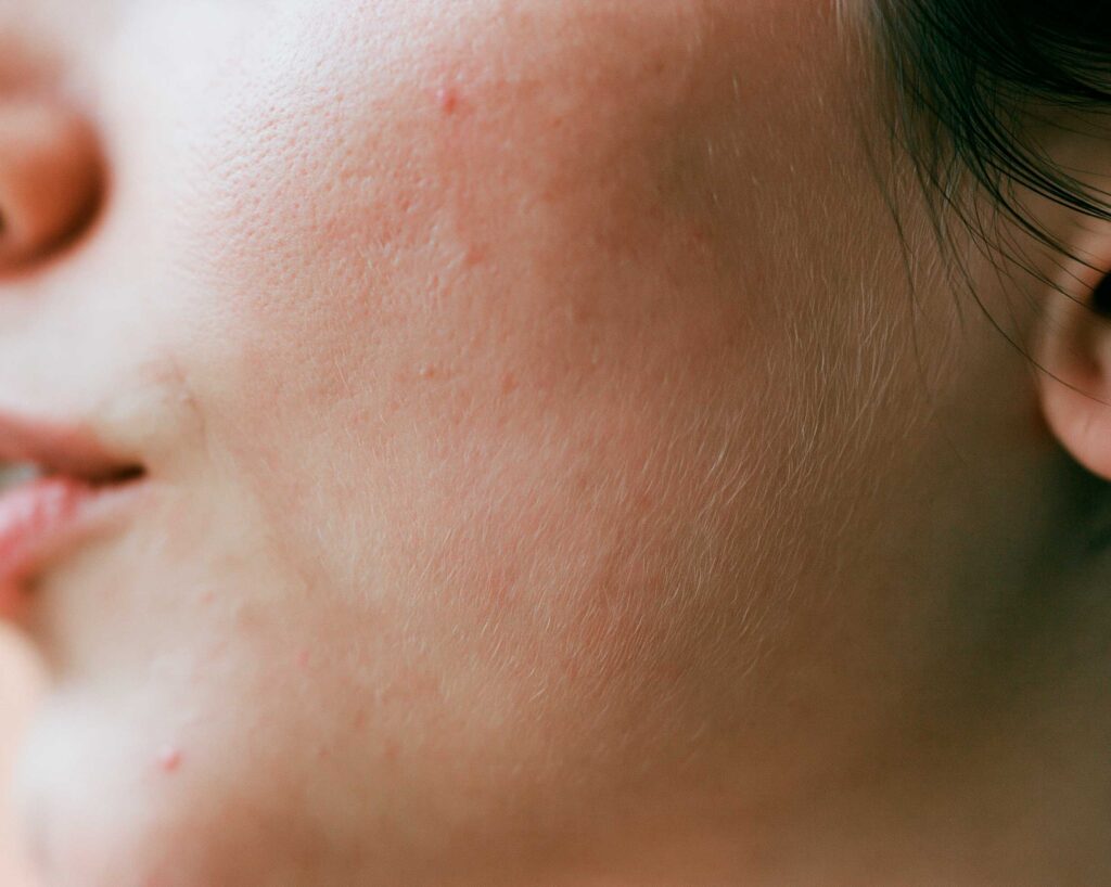 extreme close up of a womans cheekbone and jaw b73634ff 2e81 4ae7 8e21 6a75a206d802 1