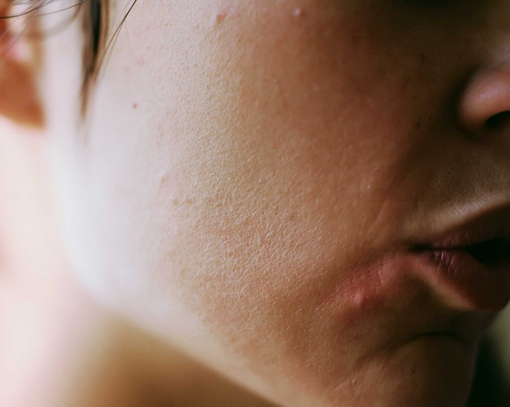 extreme close up of a womans cheekbone and jaw b73634ff 2e81 4ae7 8e21 6a75a206d802 3