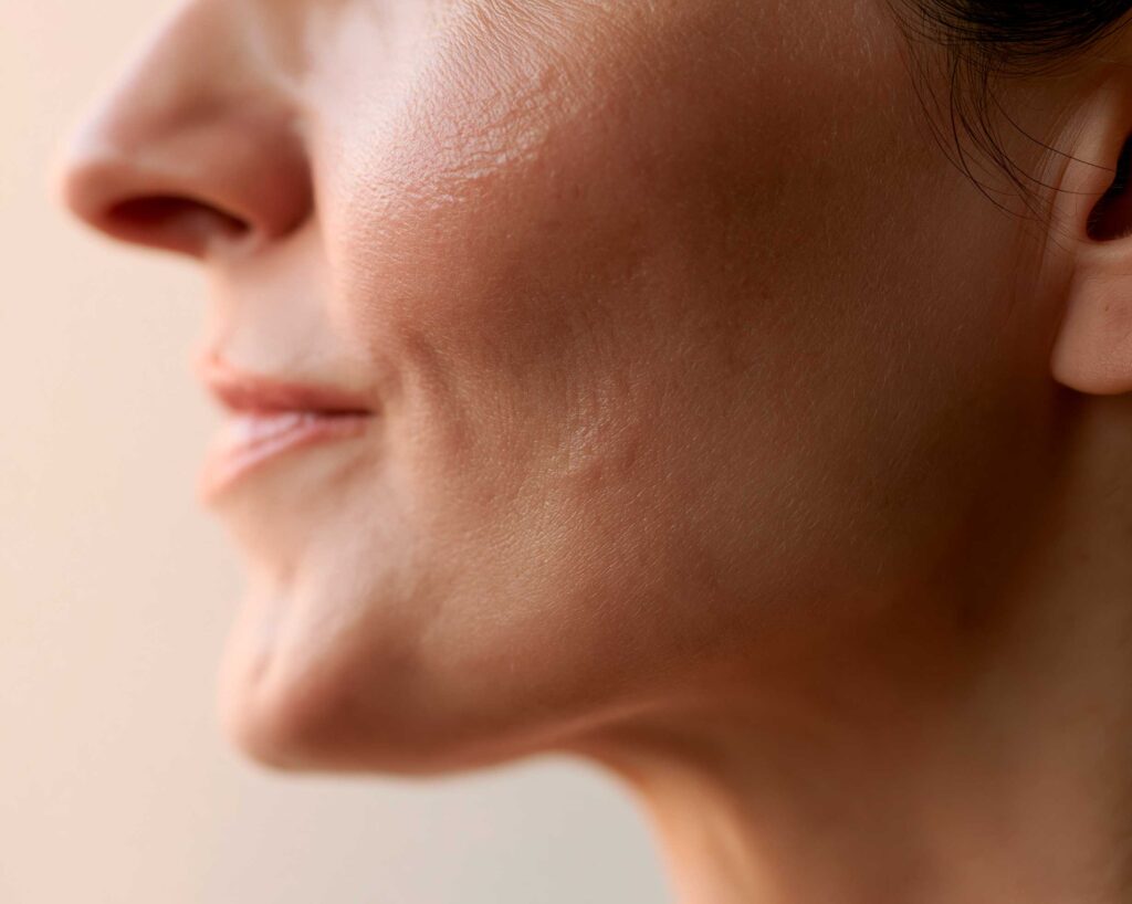 Close-up of woman's cheek and jawline skin