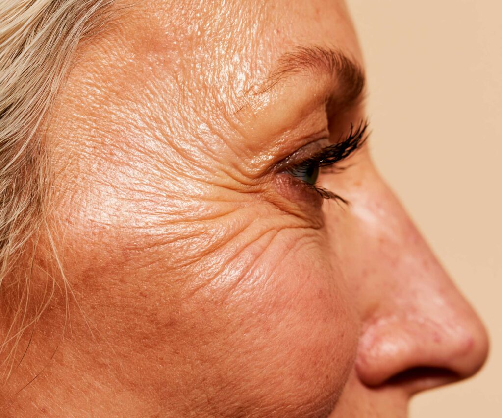 Close-up of woman's eye with crow's feet