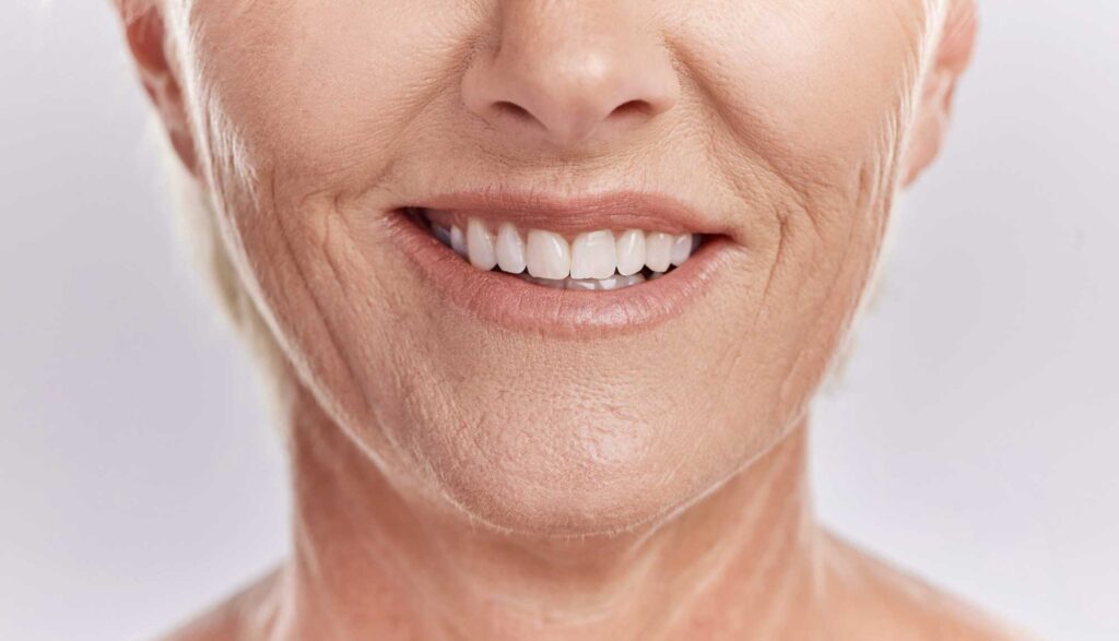 Close-up of smiling older woman's mouth and teeth