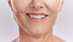 Close-up of smiling older woman's mouth and teeth
