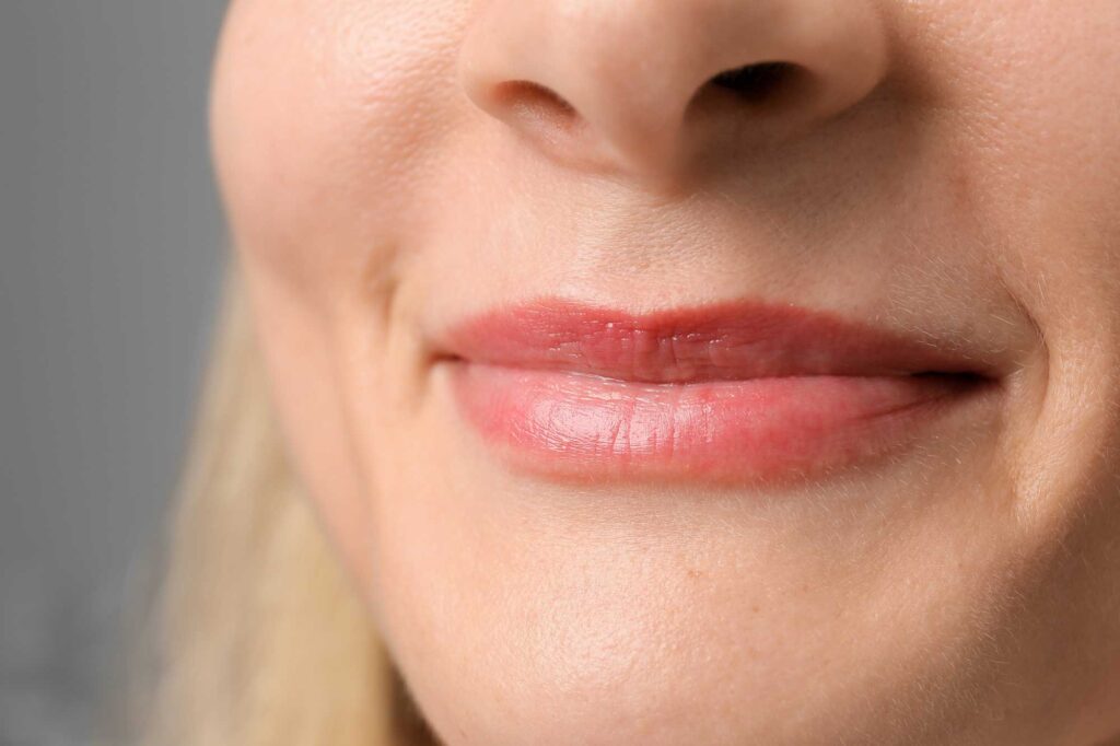 Close-up of irritated, red lips on woman