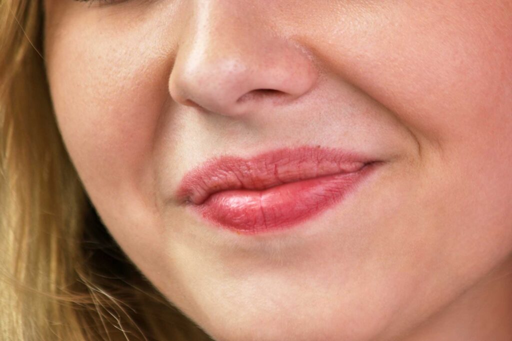 Close-up of irritated, chapped lips and mouth