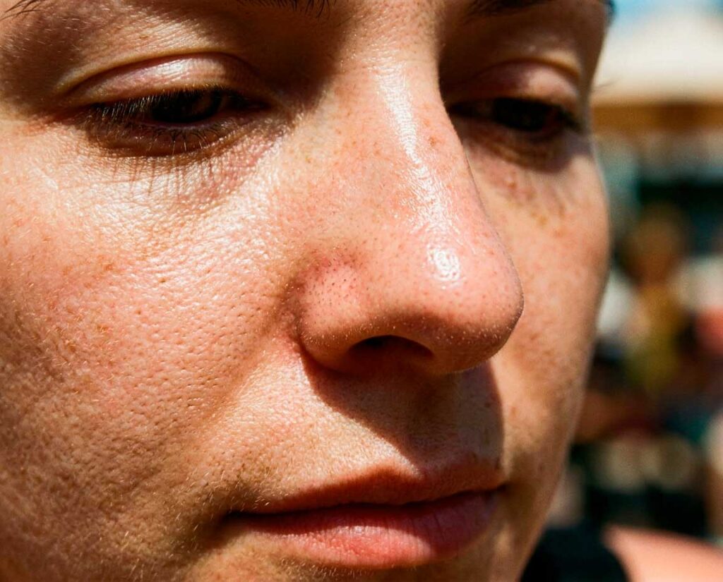 Close-up of person’s face showing skin texture
