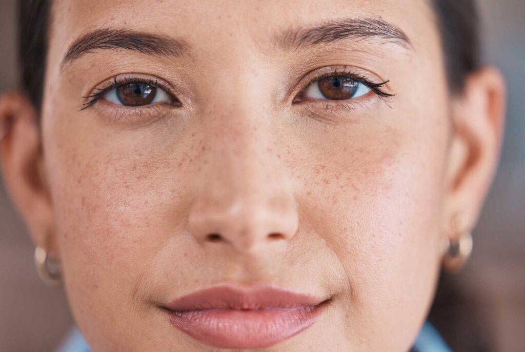 Close-up of woman’s face with natural freckles