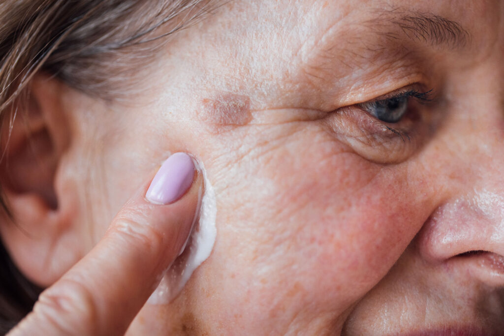 Woman applying cream to cheek with cotton pad