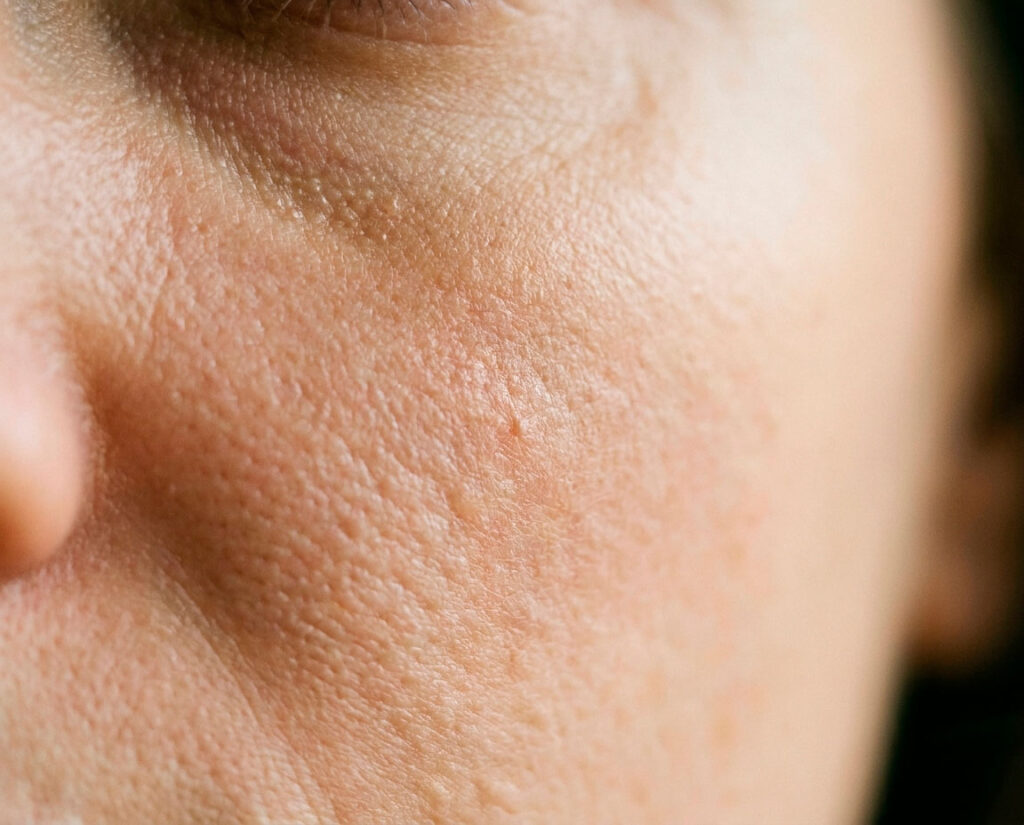 skin 20260706 021914 c56eab5f 755d 4c2a a3f2 1c76336f0b6b