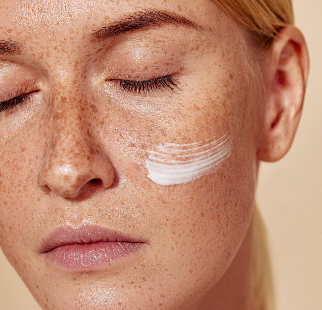 Woman applying white skincare cream to freckled cheek