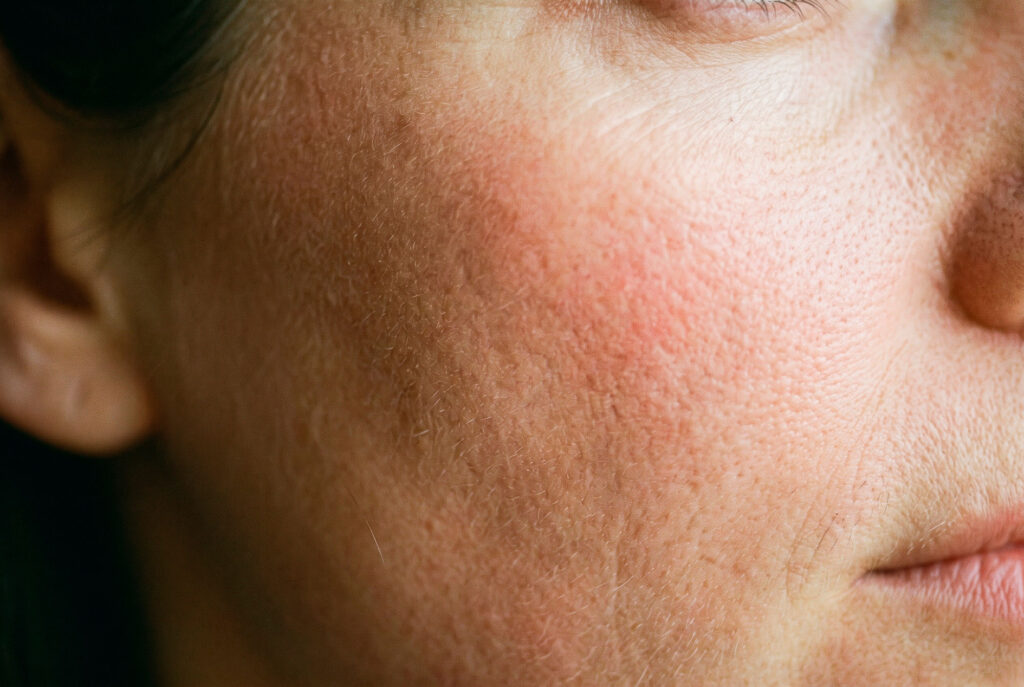 Close-up of a man's cheek with visible skin texture