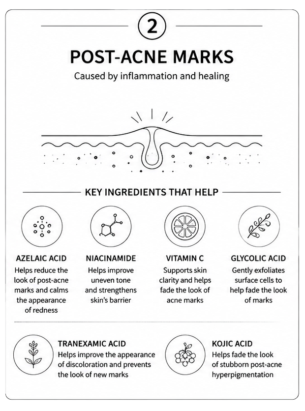 Infographic on post-acne marks and key ingredients