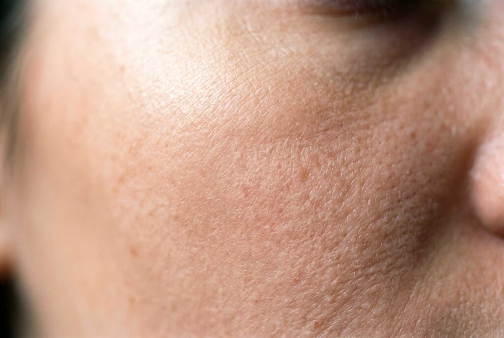Macro close-up of a person's cheek and nose skin
