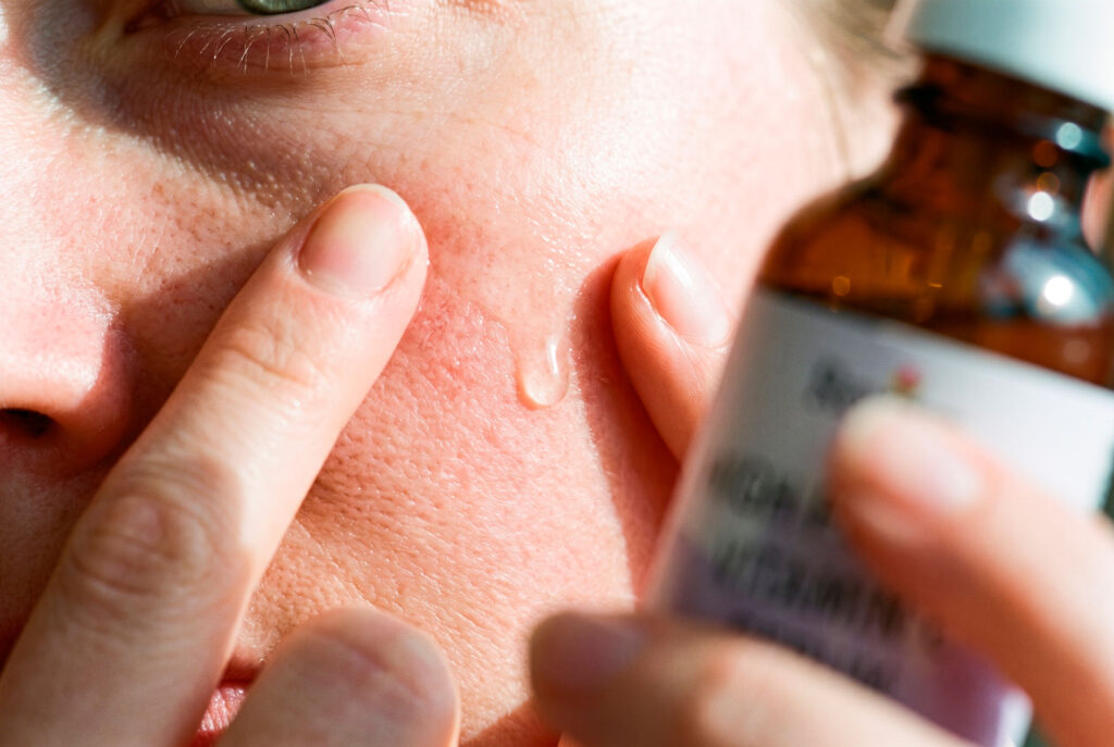 Person applies clear gel to reddened facial skin