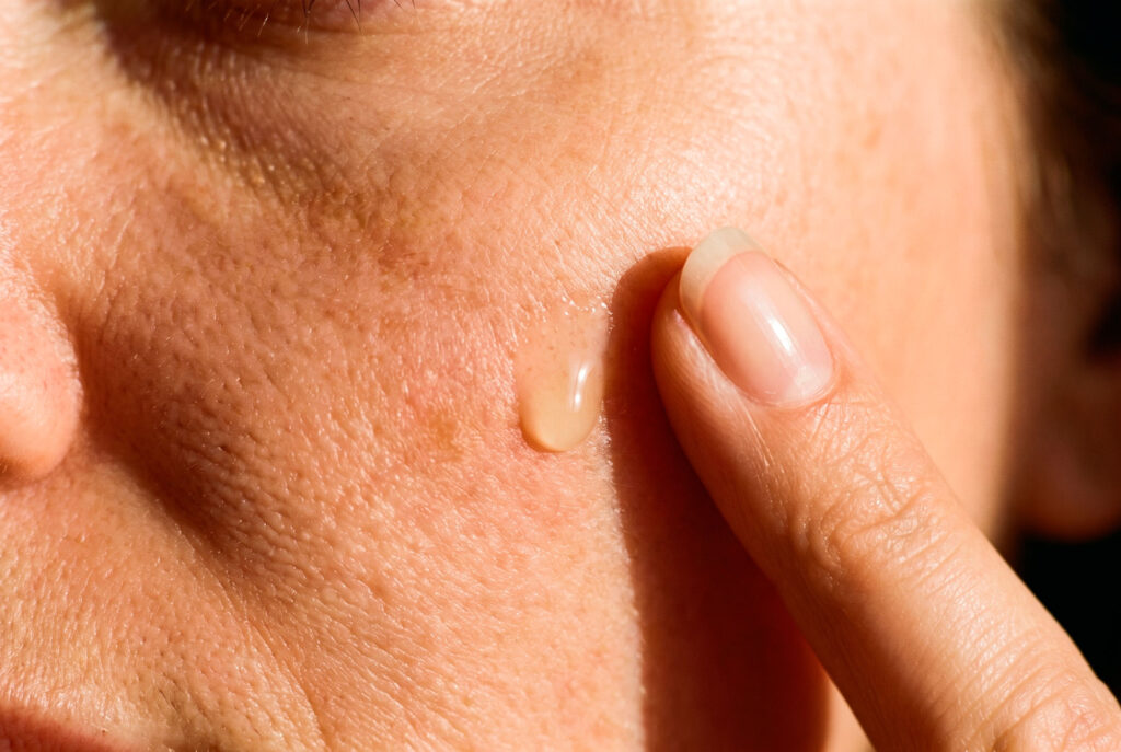 Finger applies clear gel to a person's cheek