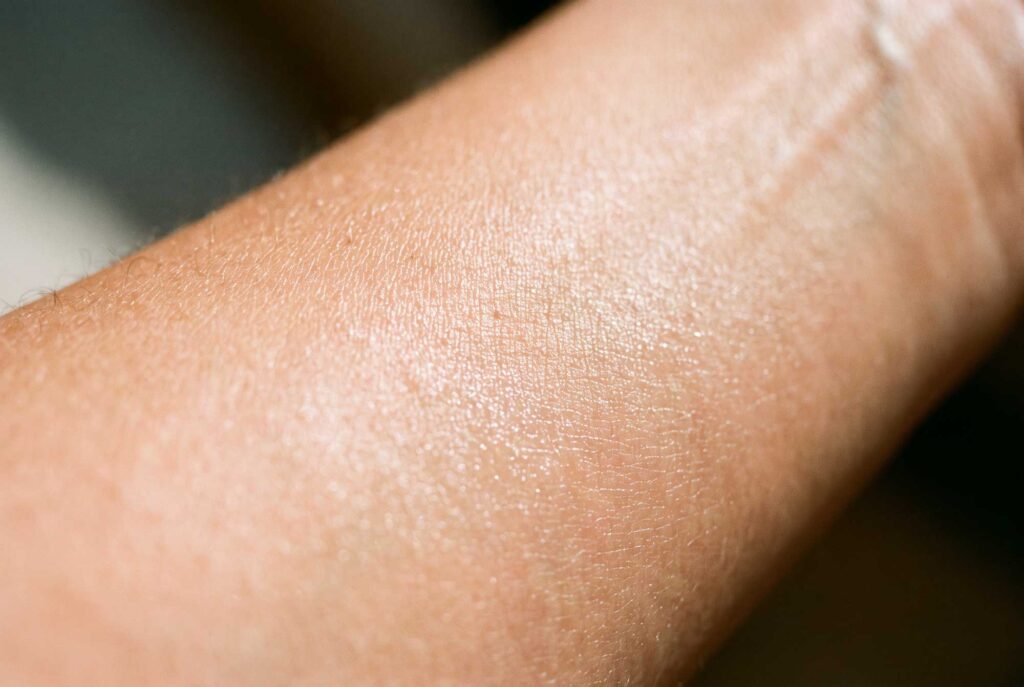 Close-up of dry, textured skin on a forearm